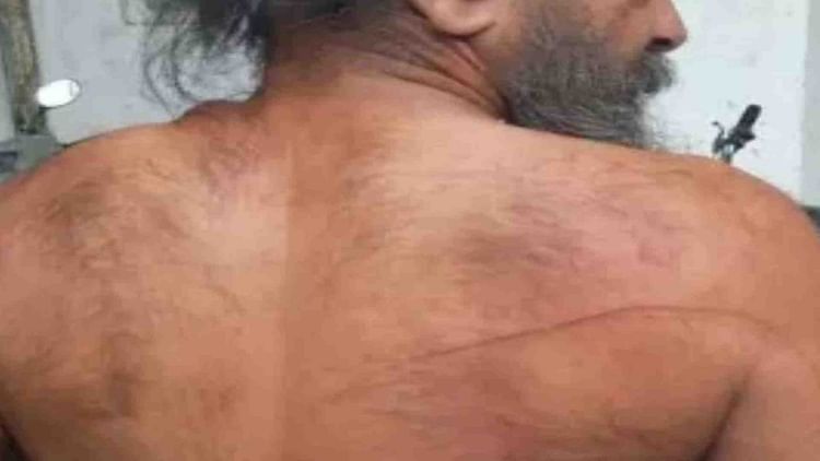 ujjain-news:-ट्राले-की-टक्कर-से-चार-गोवंशों-की-मौत,-भीड़-ने-चालक-की-पिटाई-कर-अस्पताल-में-भर्ती-कराया